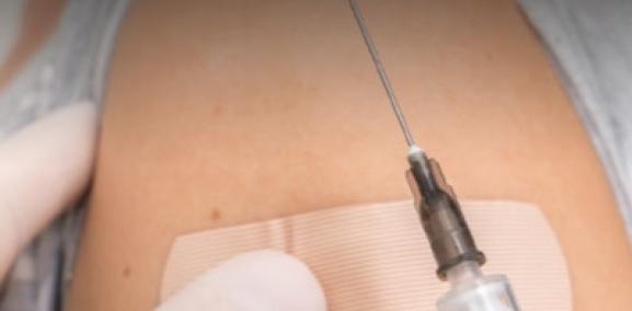 בריאות #12 - ההיסטוריה של החיסונים - פרופ' סיריל כהן