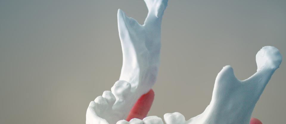 3D Jaw